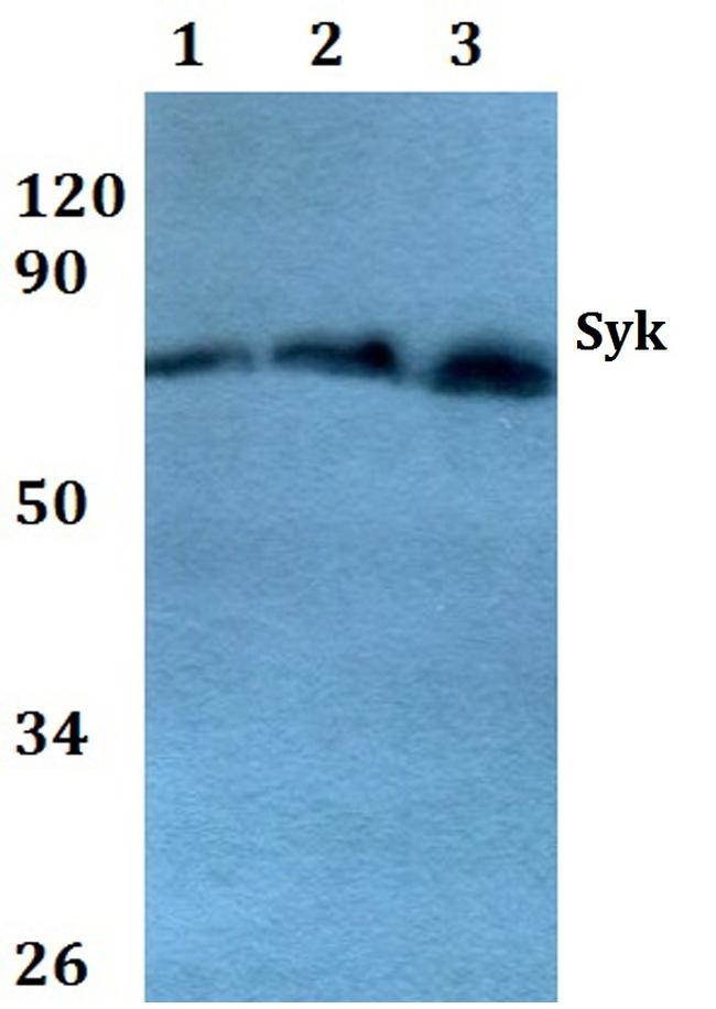 Syk Antibody in Western Blot (WB)