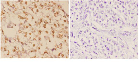 c-Abl Antibody in Immunohistochemistry (Paraffin) (IHC (P))