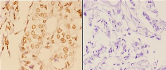 c-Abl Antibody in Immunohistochemistry (Paraffin) (IHC (P))