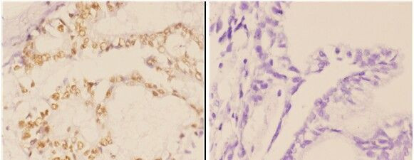 c-Abl Antibody in Immunohistochemistry (Paraffin) (IHC (P))