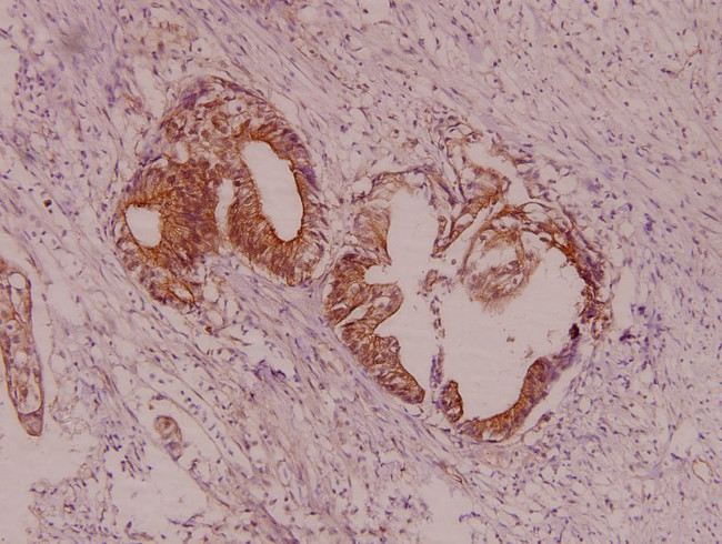 Fyn Antibody in Immunohistochemistry (Paraffin) (IHC (P))