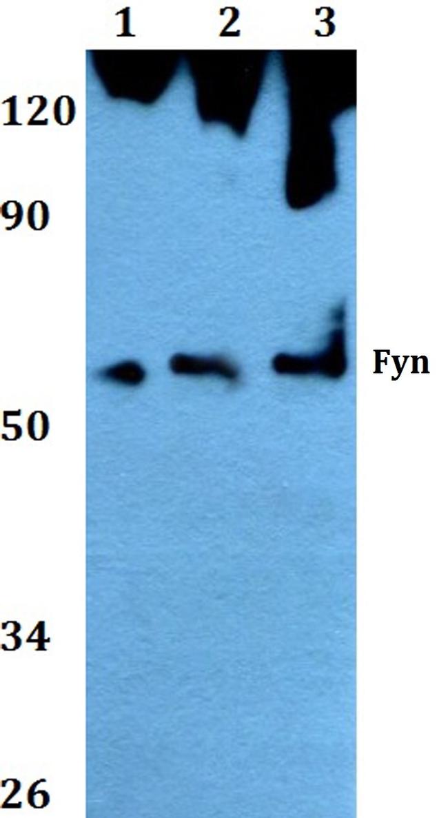 Fyn Antibody in Western Blot (WB)