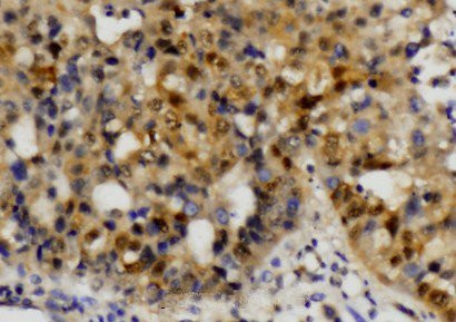 ETS1 Antibody in Immunohistochemistry (Paraffin) (IHC (P))