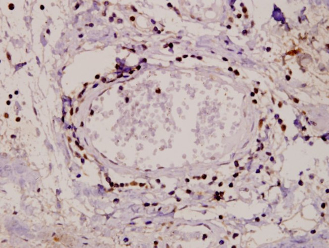 PKC alpha Antibody in Immunohistochemistry (Paraffin) (IHC (P))