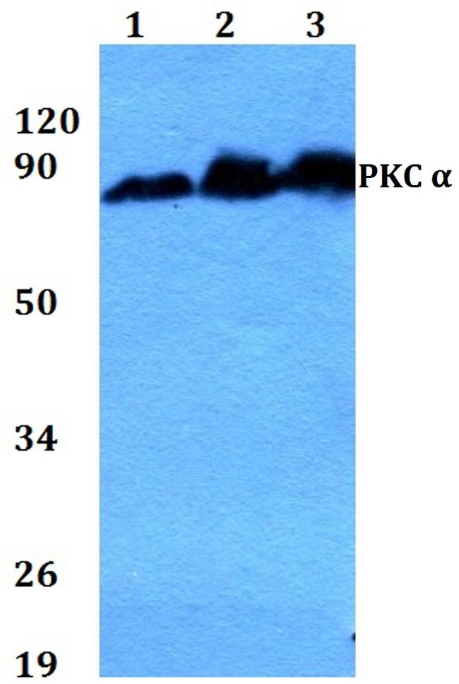 PKC alpha Antibody in Western Blot (WB)