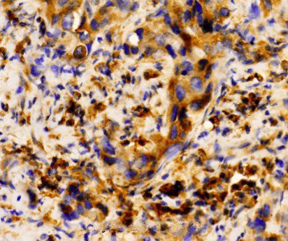 S100A8 Antibody in Immunohistochemistry (Paraffin) (IHC (P))