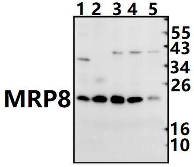 S100A8 Antibody in Western Blot (WB)