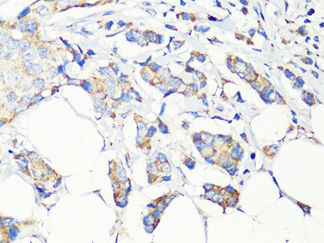 Beclin 1 Antibody in Immunohistochemistry (Paraffin) (IHC (P))