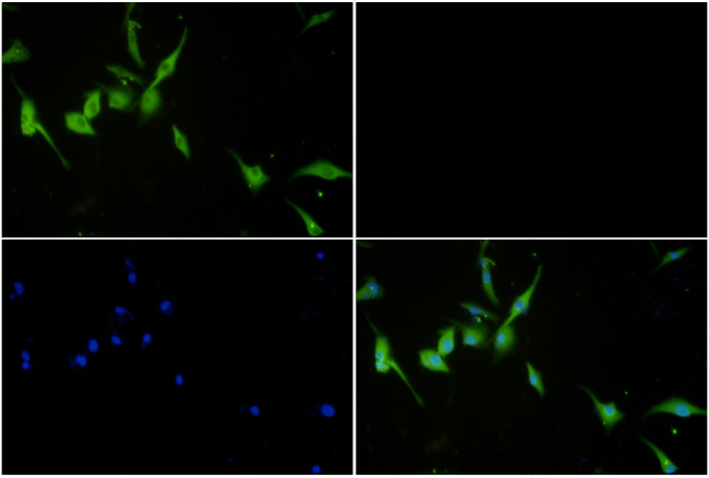 SQSTM1 Antibody in Immunohistochemistry (Paraffin) (IHC (P))