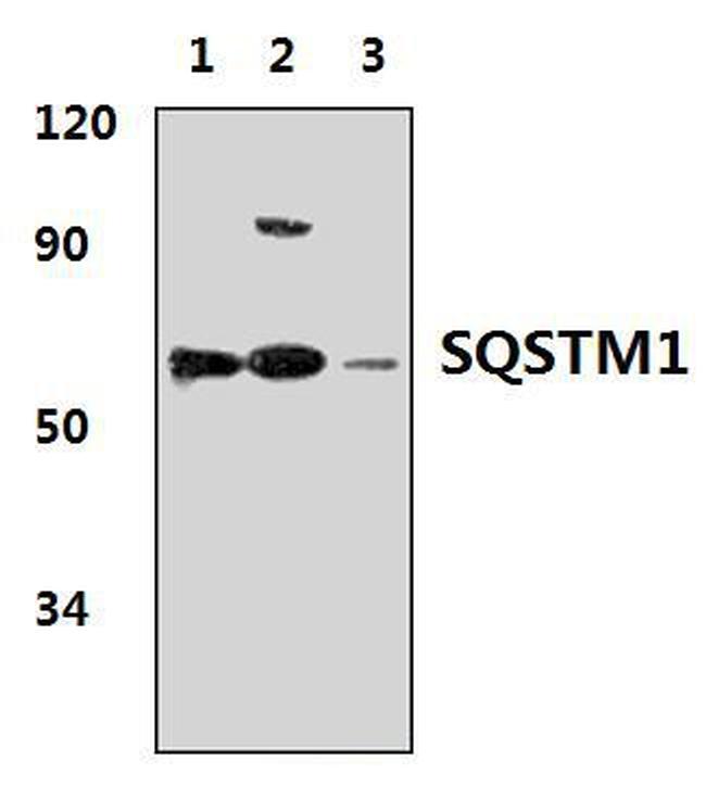 SQSTM1 Antibody in Western Blot (WB)