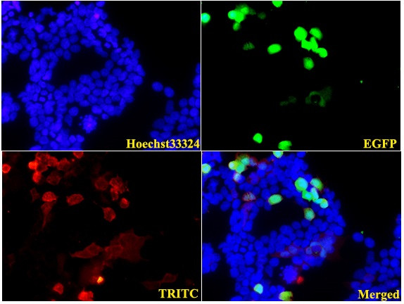 LC3B Antibody in Immunocytochemistry (ICC/IF)