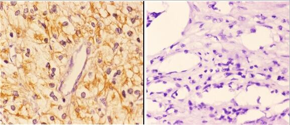 14-3-3 zeta Antibody in Immunohistochemistry (Paraffin) (IHC (P))