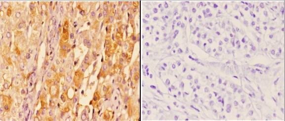 14-3-3 zeta Antibody in Immunohistochemistry (Paraffin) (IHC (P))