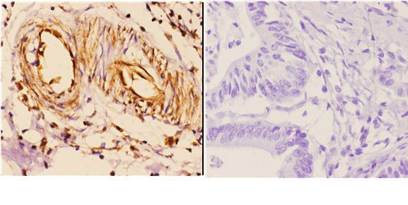 14-3-3 zeta Antibody in Immunohistochemistry (Paraffin) (IHC (P))