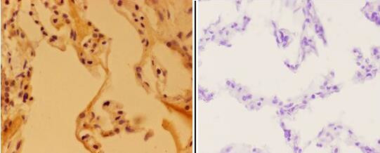 APAF1 Antibody in Immunohistochemistry (Paraffin) (IHC (P))