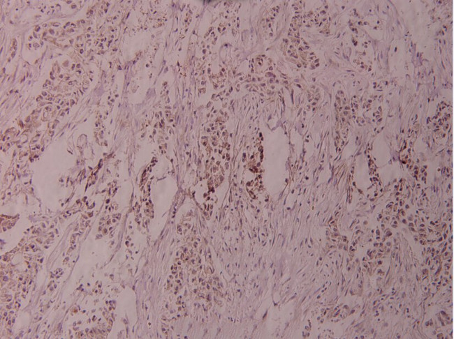 ATF2 Antibody in Immunohistochemistry (Paraffin) (IHC (P))