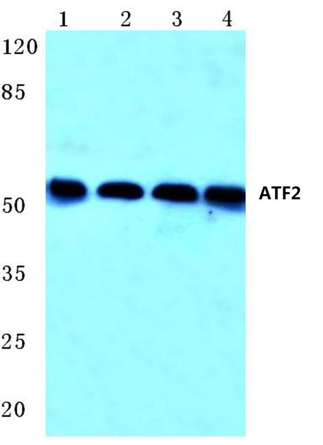 ATF2 Antibody in Western Blot (WB)