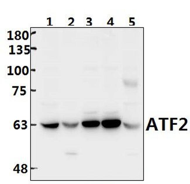 ATF2 Antibody in Western Blot (WB)