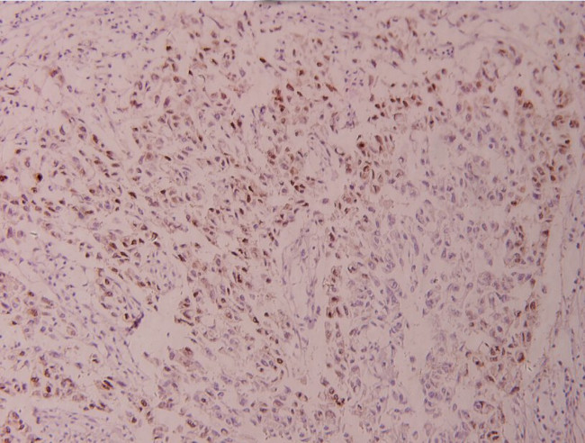 ATF2 Antibody in Immunohistochemistry (Paraffin) (IHC (P))