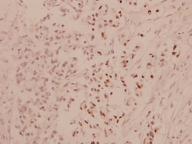 ATF4 Antibody in Immunohistochemistry (Paraffin) (IHC (P))