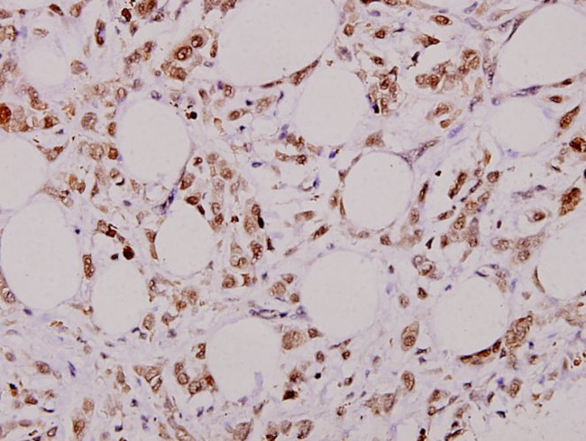 Bcl-X Antibody in Immunohistochemistry (Paraffin) (IHC (P))