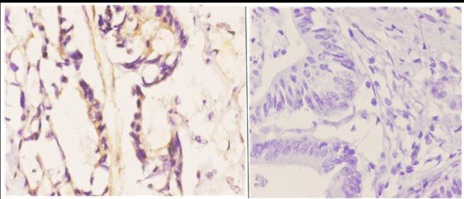 Bim Antibody in Immunohistochemistry (Paraffin) (IHC (P))