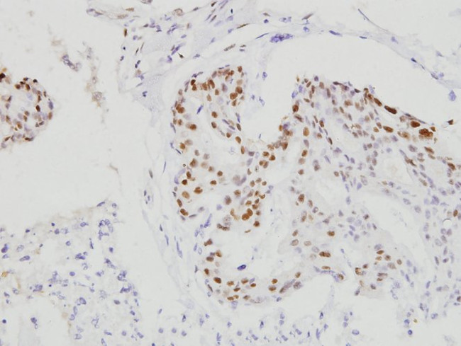 C/EBP beta Antibody in Immunohistochemistry (Paraffin) (IHC (P))