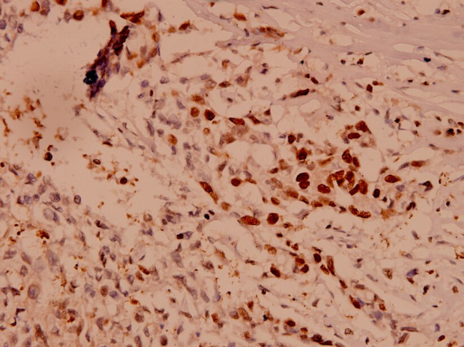 Caspase 10 Antibody in Immunohistochemistry (Paraffin) (IHC (P))