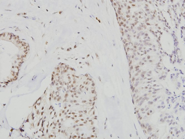 Cdc6 Antibody in Immunohistochemistry (Paraffin) (IHC (P))