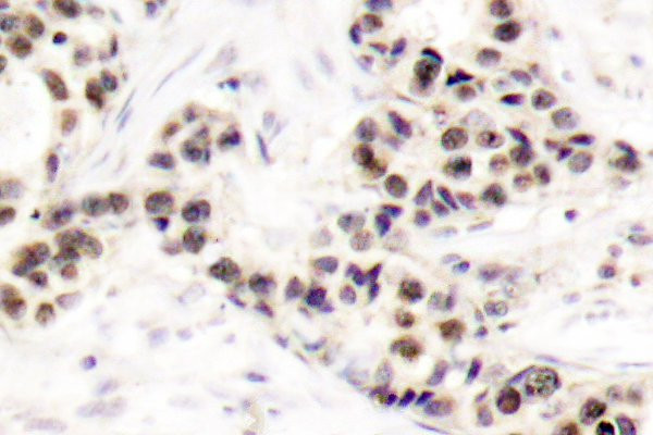 CHK2 Antibody in Immunohistochemistry (Paraffin) (IHC (P))