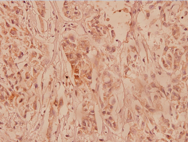 Collagen II Antibody in Immunohistochemistry (Paraffin) (IHC (P))