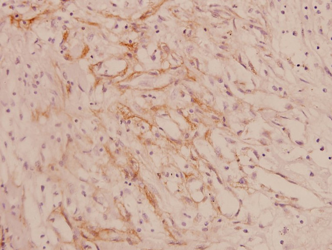 COL4A1 Antibody in Immunohistochemistry (Paraffin) (IHC (P))