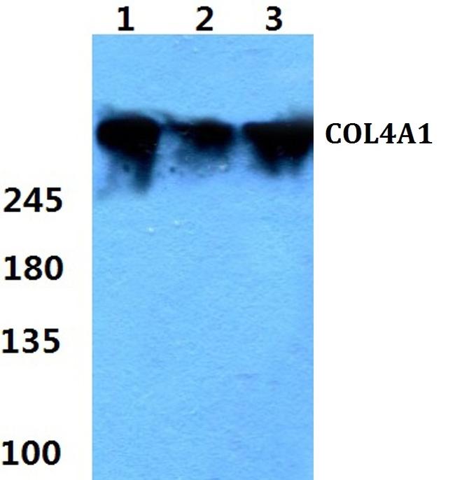 COL4A1 Antibody in Western Blot (WB)