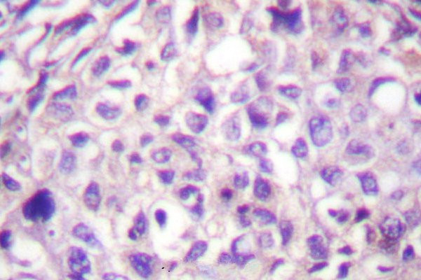 TPL2 Antibody in Immunohistochemistry (Paraffin) (IHC (P))