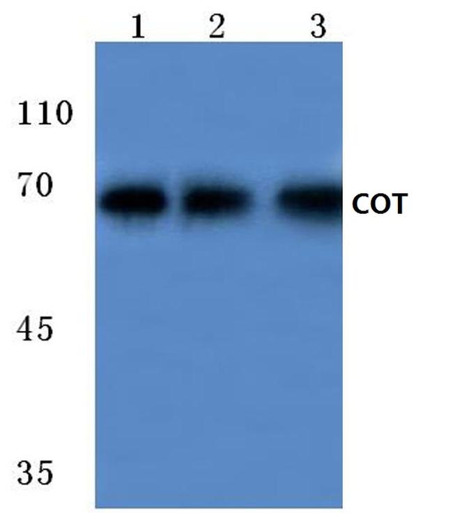 TPL2 Antibody in Western Blot (WB)