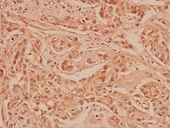 COX2 Antibody in Immunohistochemistry (Paraffin) (IHC (P))