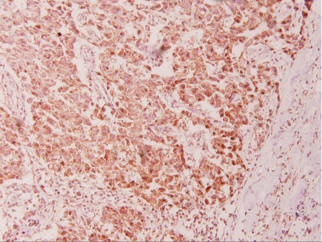 CAS Antibody in Immunohistochemistry (Paraffin) (IHC (P))