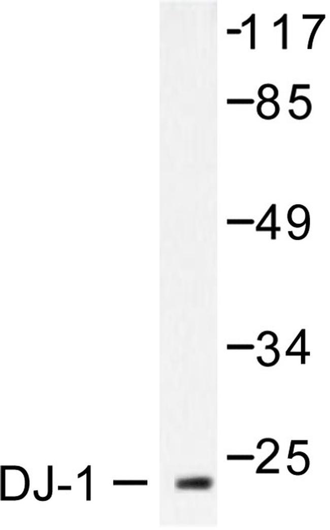 DJ-1 Antibody in Western Blot (WB)