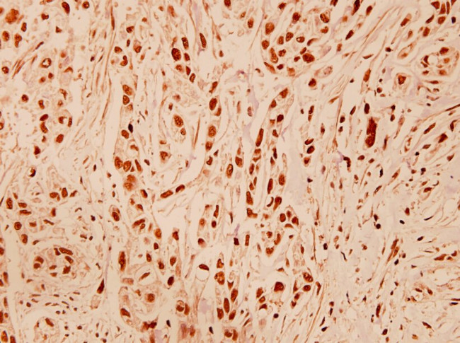 DNA-PK Antibody in Immunohistochemistry (Paraffin) (IHC (P))