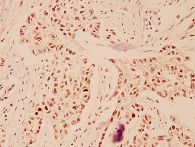 DP1 Antibody in Immunohistochemistry (Paraffin) (IHC (P))