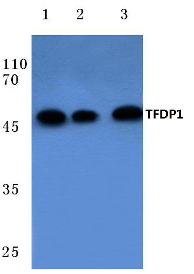 DP1 Antibody in Western Blot (WB)