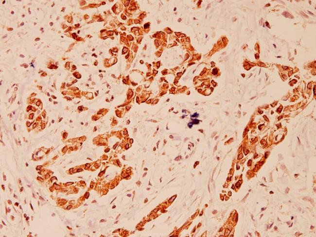 EEF2 Antibody in Immunohistochemistry (Paraffin) (IHC (P))