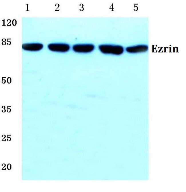 Ezrin Antibody in Western Blot (WB)