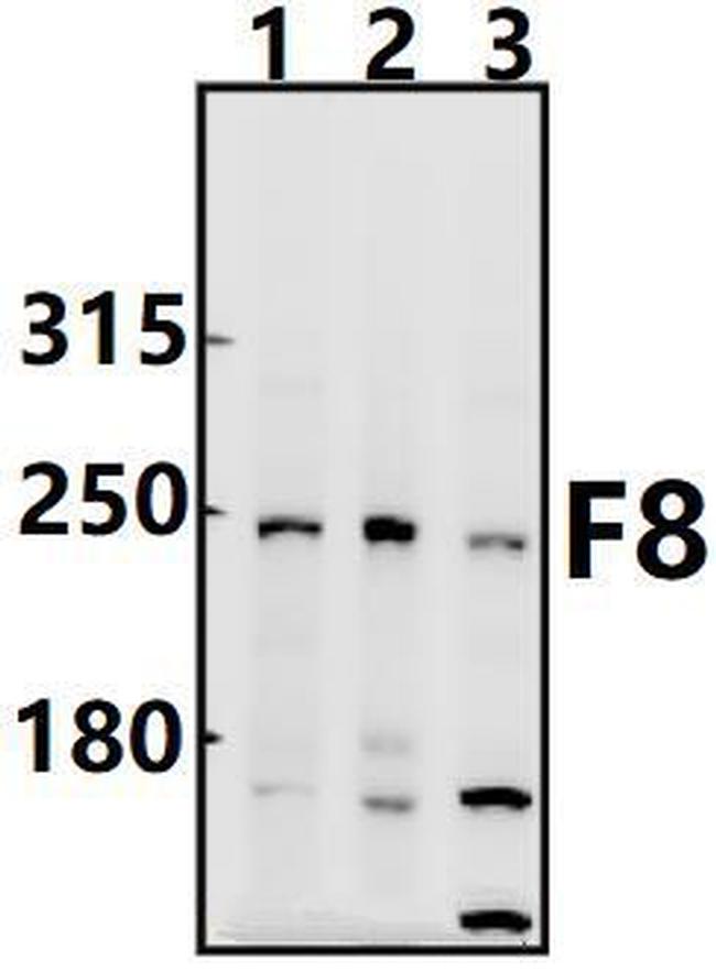 Factor VIII Antibody in Western Blot (WB)