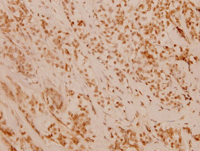 FANCD2 Antibody in Immunohistochemistry (Paraffin) (IHC (P))