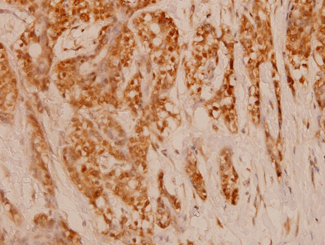 FAP Antibody in Immunohistochemistry (Paraffin) (IHC (P))