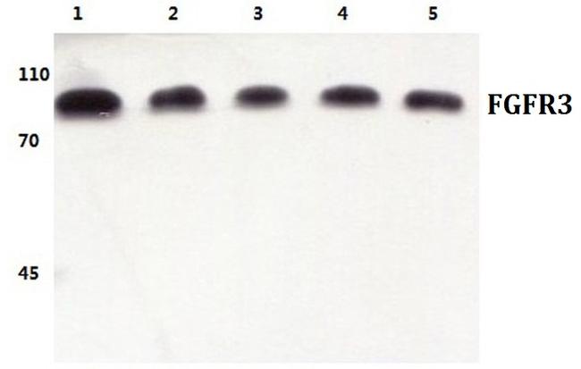 FGFR3 Antibody in Western Blot (WB)