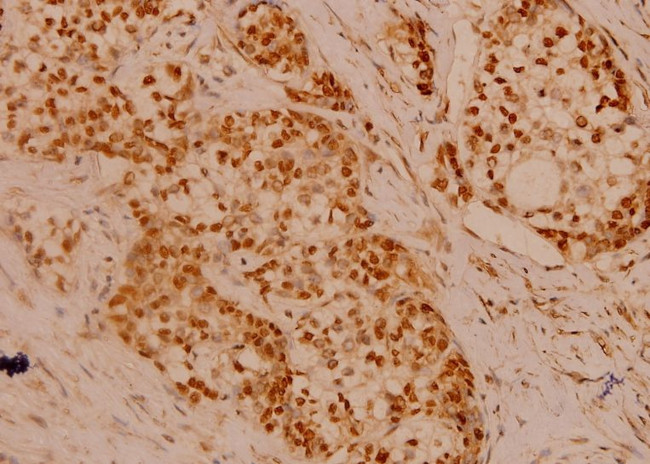 Filamin A Antibody in Immunohistochemistry (Paraffin) (IHC (P))