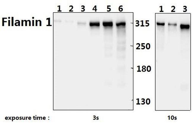 Filamin A Antibody in Western Blot (WB)