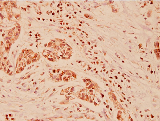 Galectin 3 Antibody in Immunohistochemistry (Paraffin) (IHC (P))